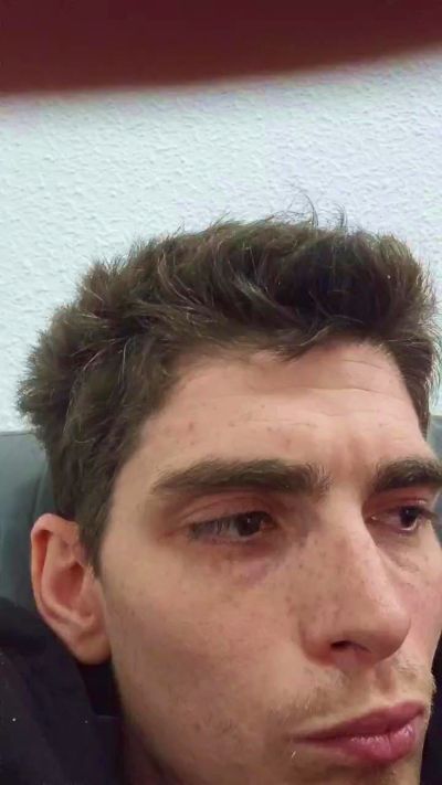 albertillo2 Live Image